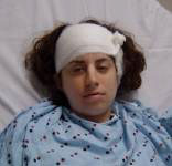 Lisa after surgery